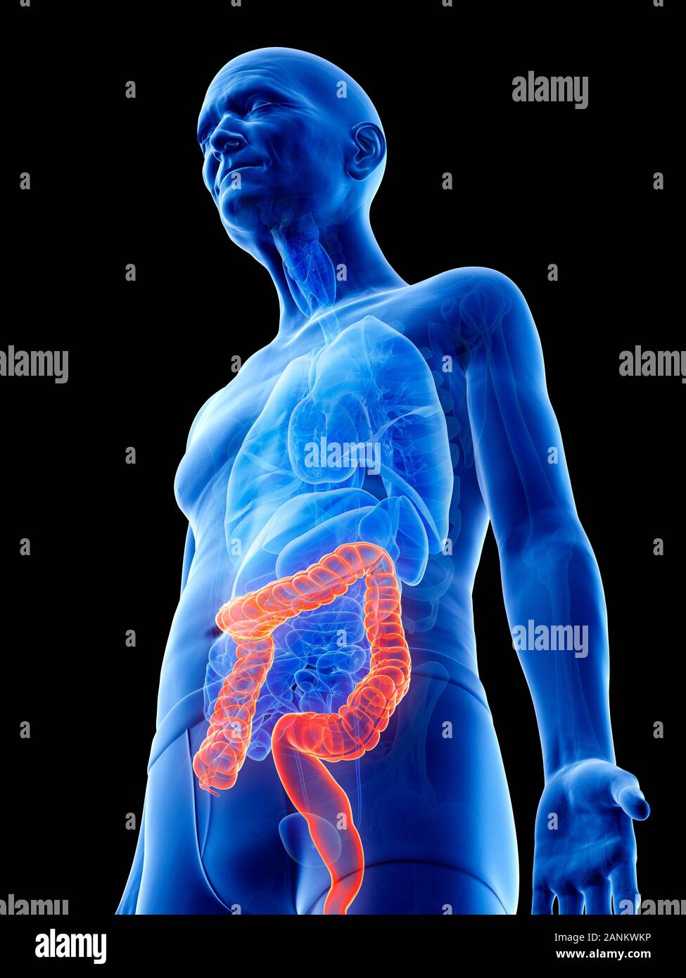 Illustration of an old man's colon Stock Photo - Alamy