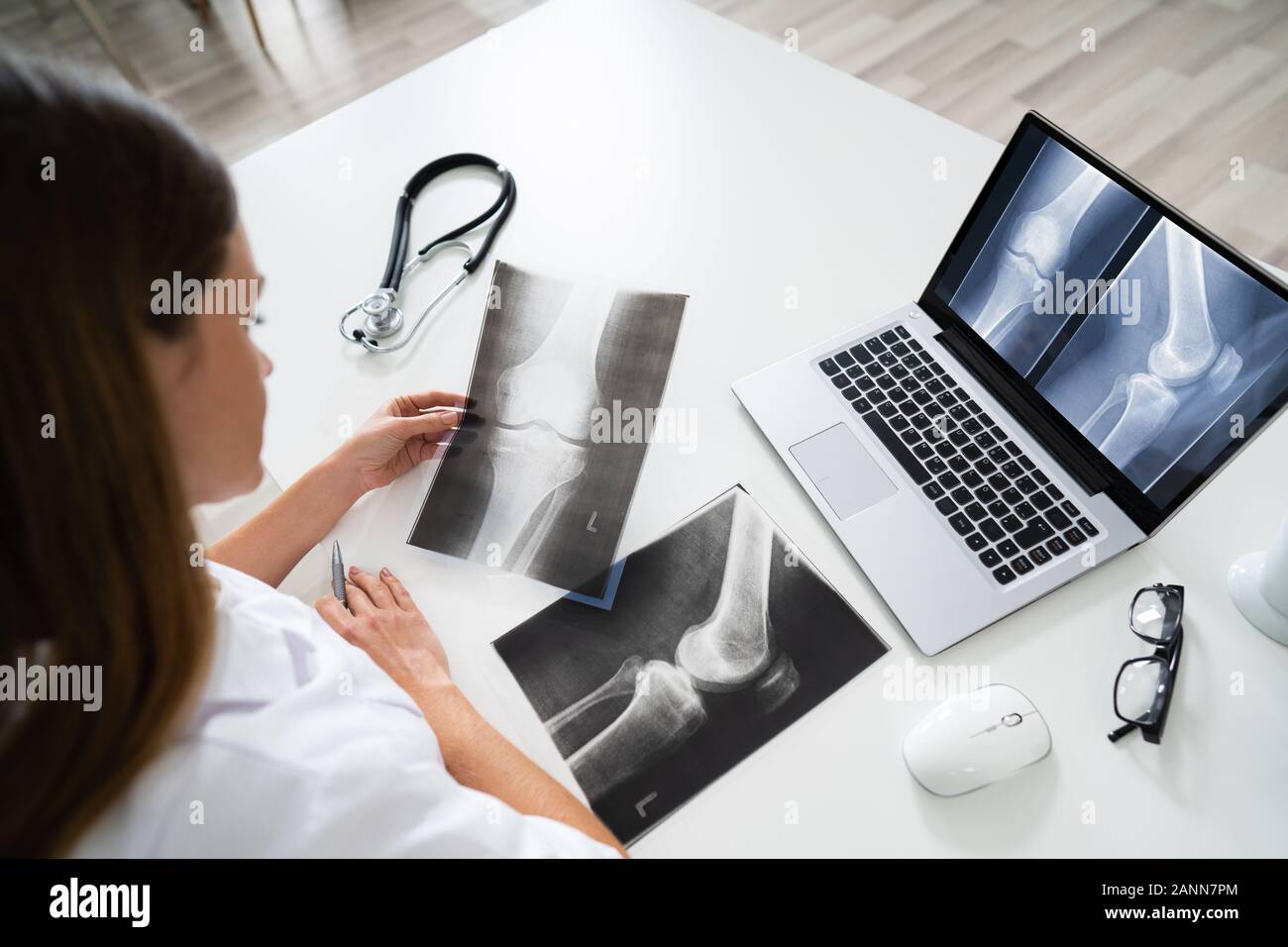 Doctor Looking At Foot X-ray On Laptop With Stethoscope Stock Photo