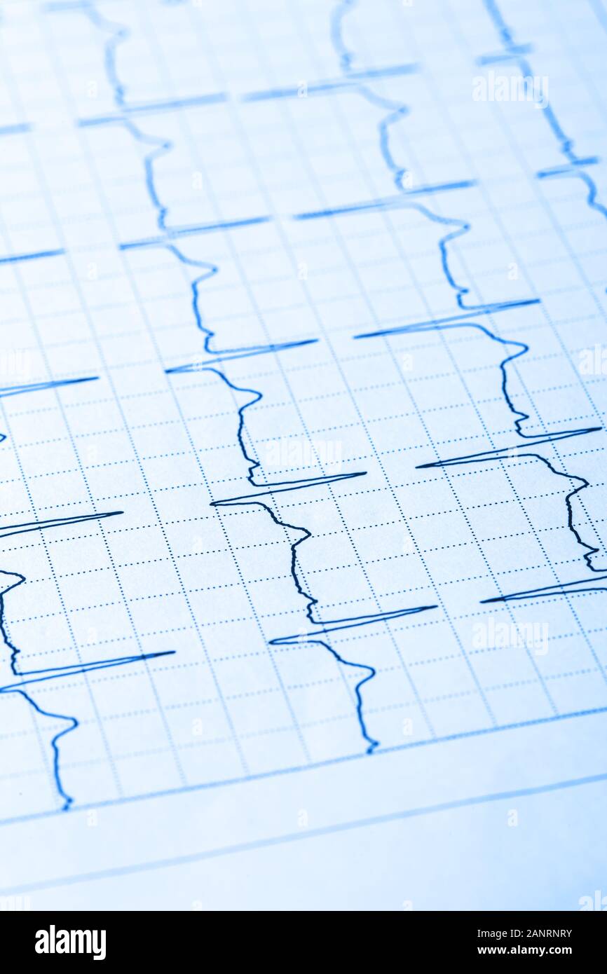 Cardiogram paper closeup Stock Photo