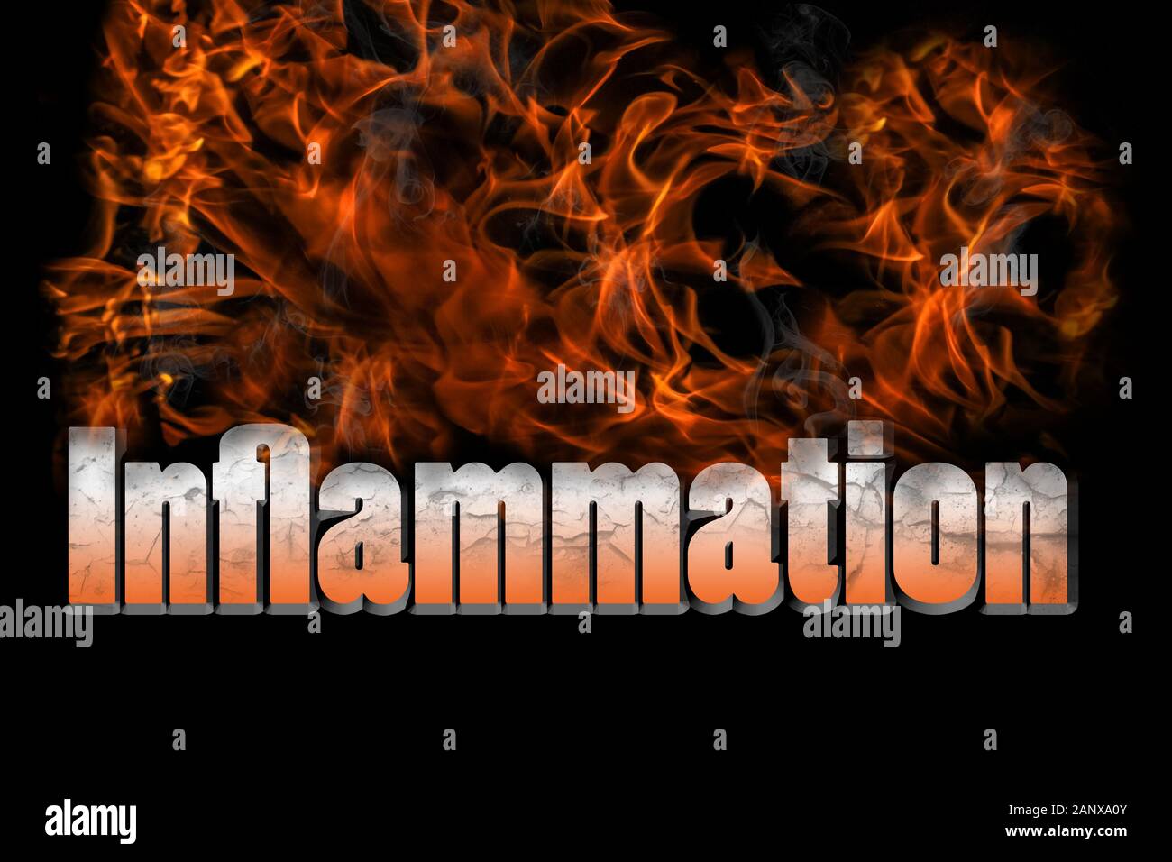 Inflammation 3D illustration fire text with crackled and burnt word with flames and smoke on a black background.  Great for medical and healthcare. Stock Photo