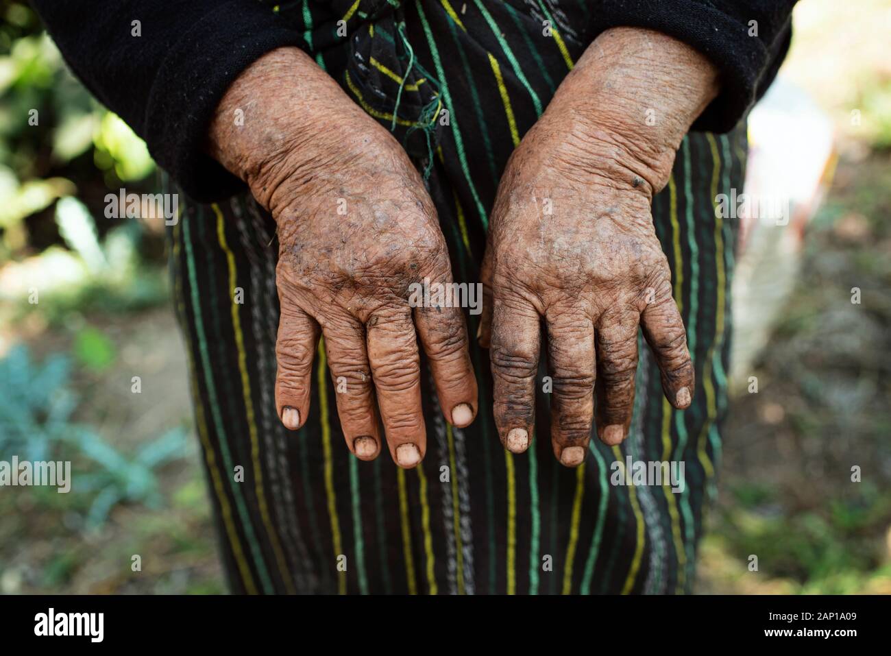Hands of indigenous elderly woman. She is working 5am - 8pm daily on a coffee plantation near Calle San Lazaro, Antigua, Guatemala. Jan 2019 Stock Photo