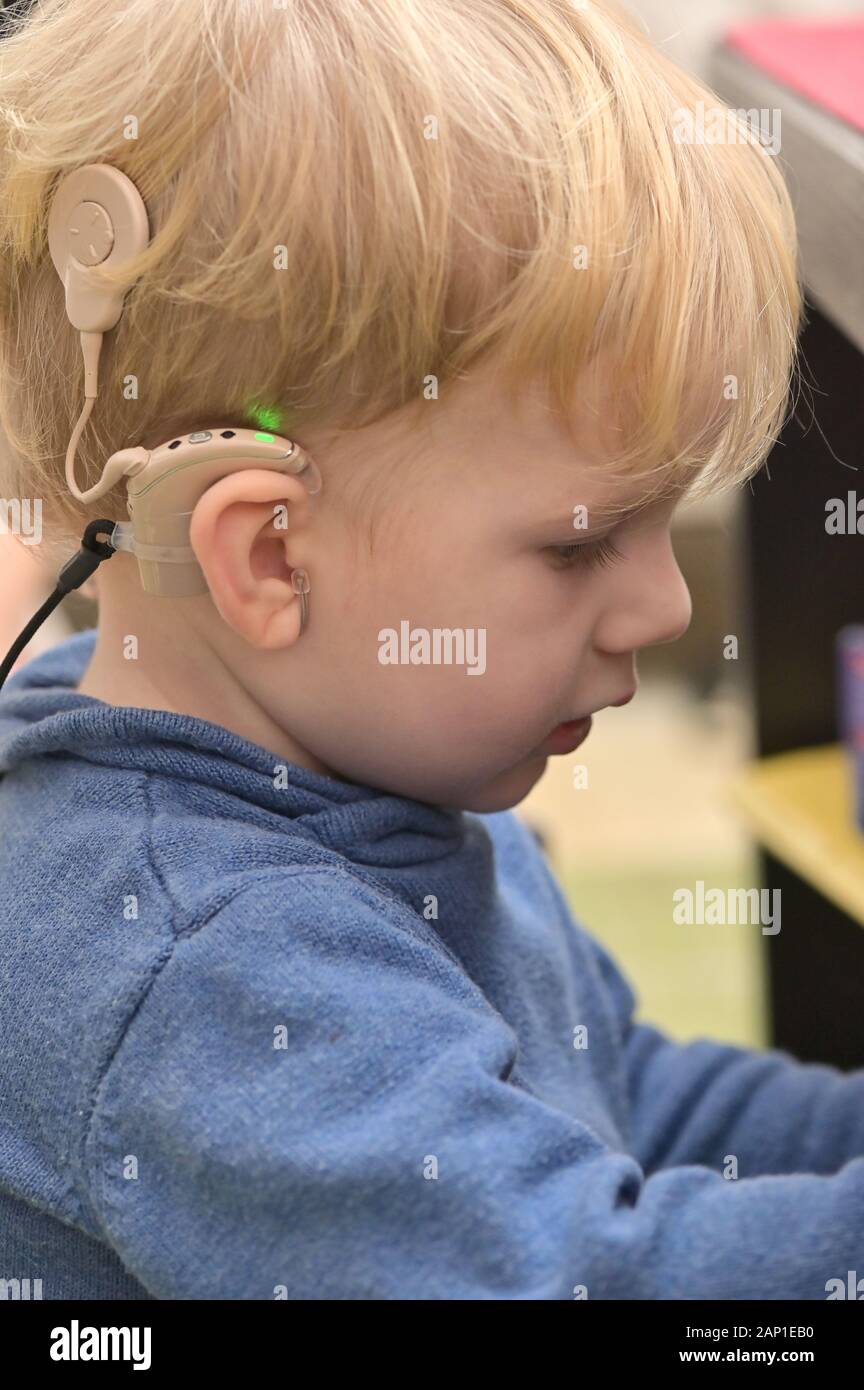 A Boy With A Hearing Aids And Cochlear Implants Stock Photo Alamy