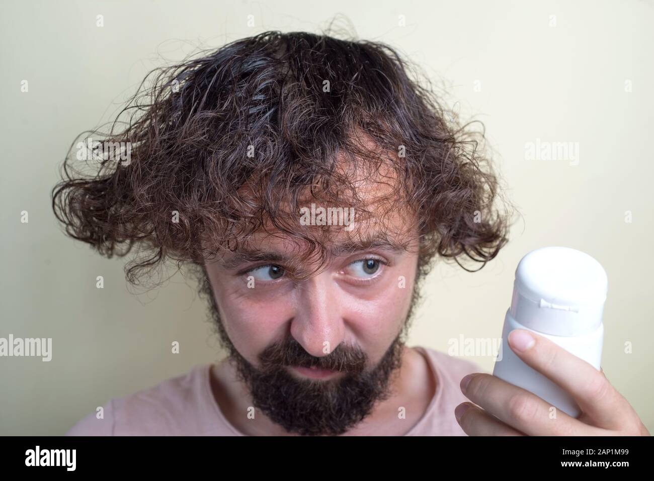 Portrait Of A Young Guy With Long Dirty Hair And Problematic Scalp