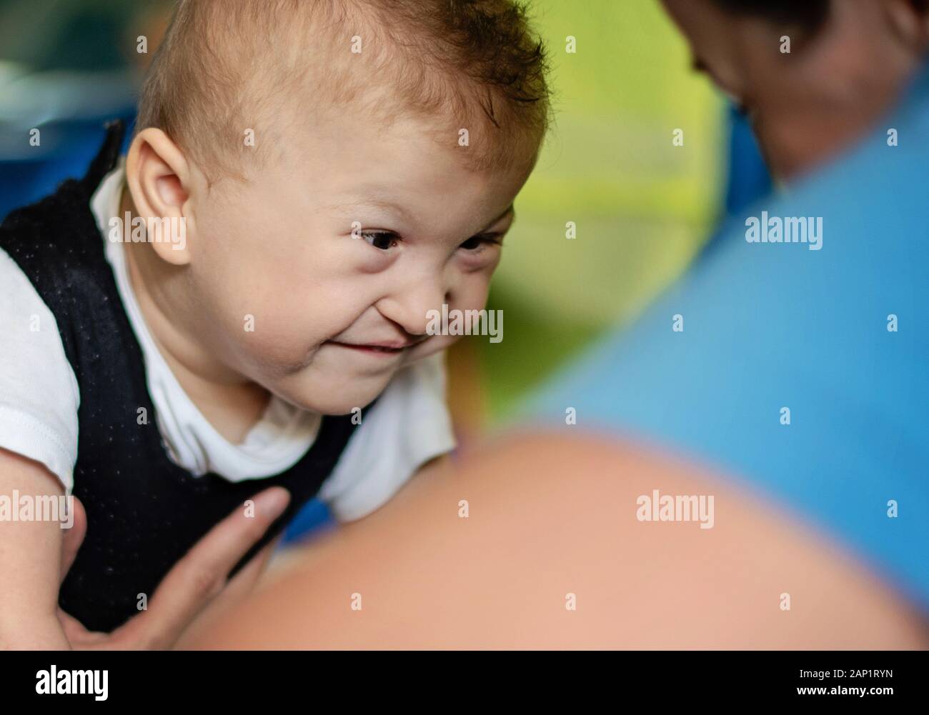 Portrait of a smiling baby with cerebral palsy on physiotherapy in a children therapy center. Boy with disability has therapy by doing exercises. Stock Photo