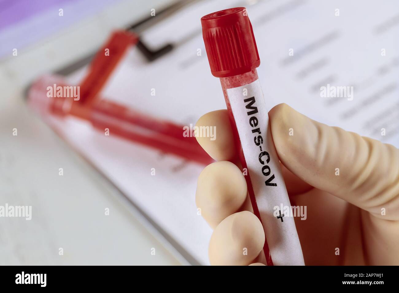 MERS virus definition Middle East Respiratory Syndrome Blood sample