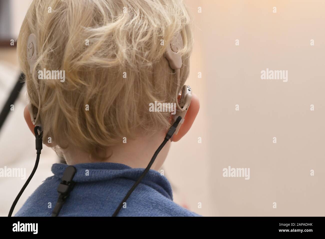 A Boy With A Hearing Aids And Cochlear Implants Stock Photo