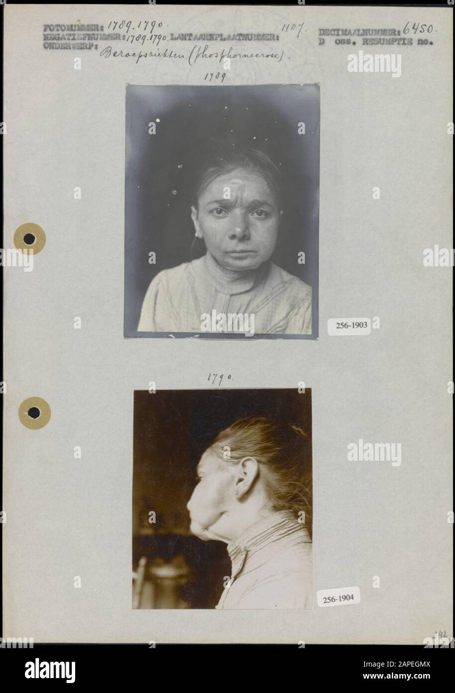 Phosphorus jaw hires stock photography and images Alamy