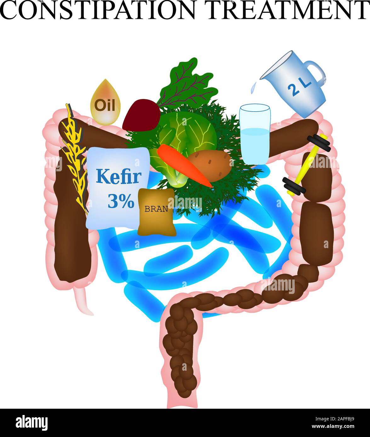 Treatment of constipation. Infographics. Vector illustration on ...