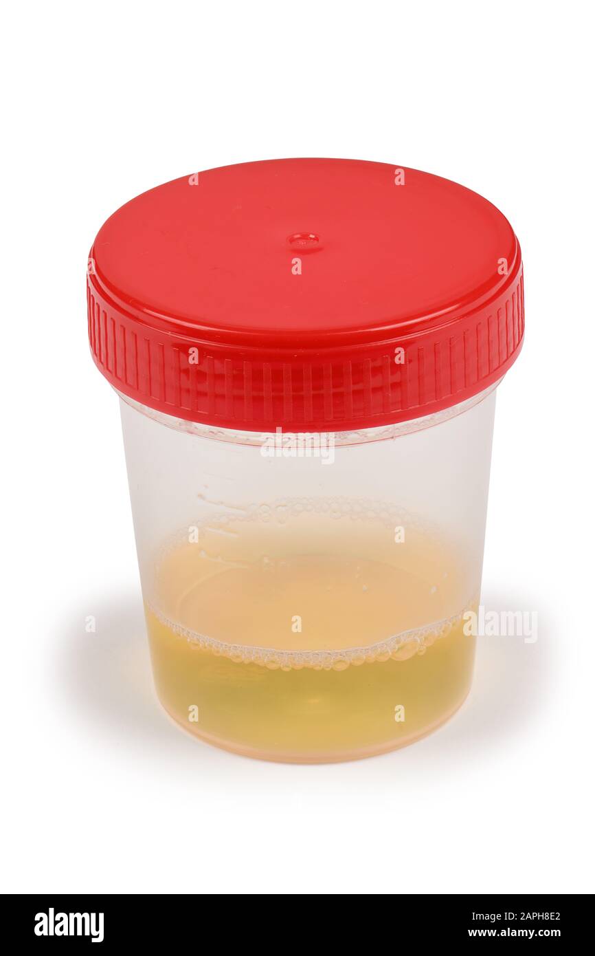 Urine sample in container. High resolution photo. With clipping path