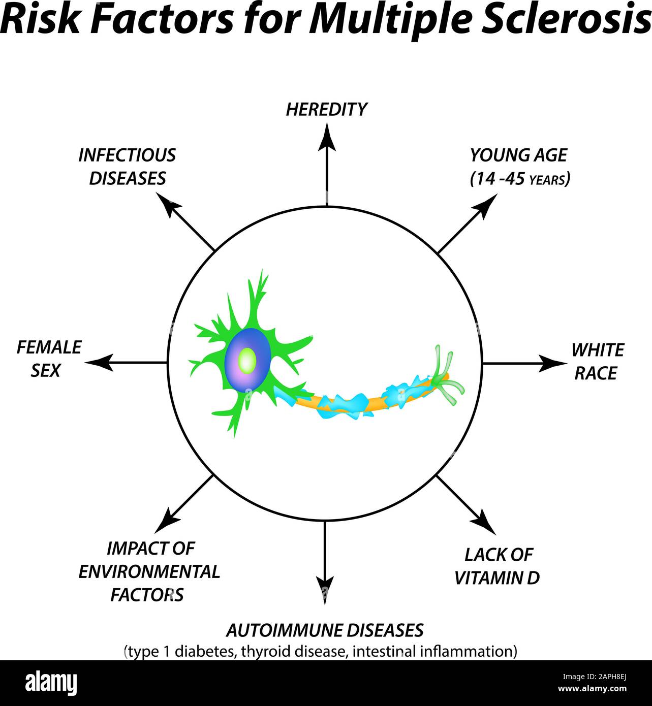 Multiple Sclerosis Illustration High Resolution Stock Photography and
