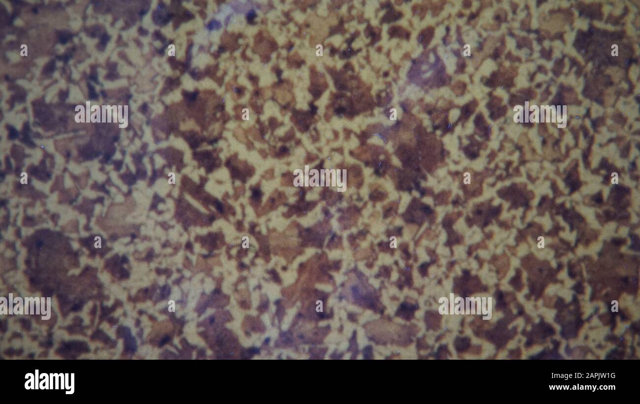 metallurgical micrograph of ball bearing steel annealed condition
