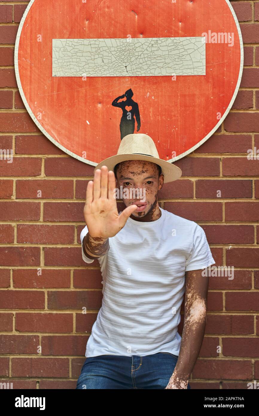 Portrait of young man with vitiligo wearing a hat doing a stop sign with his hand on a forbidden sign Stock Photo