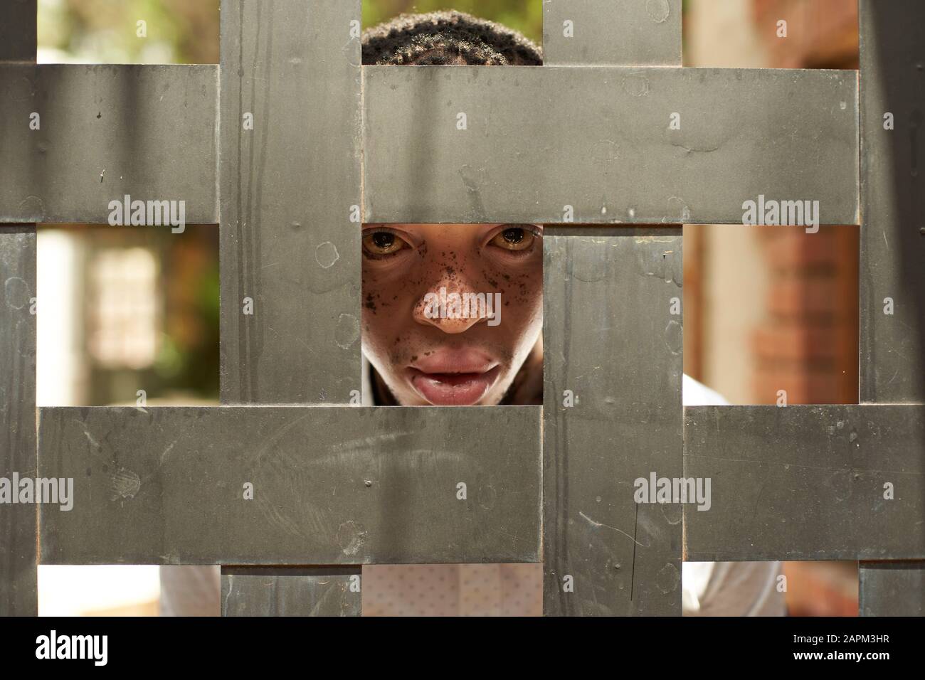 Portrait of young man with vitiligo behind wooden fence Stock Photo