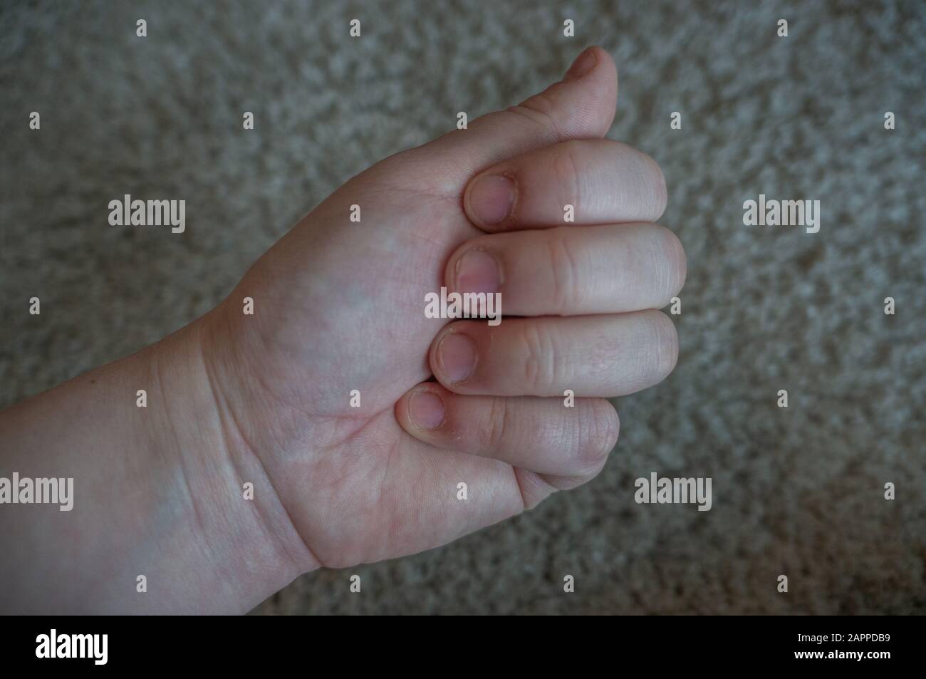 Biting nail not woman hires stock photography and images Alamy