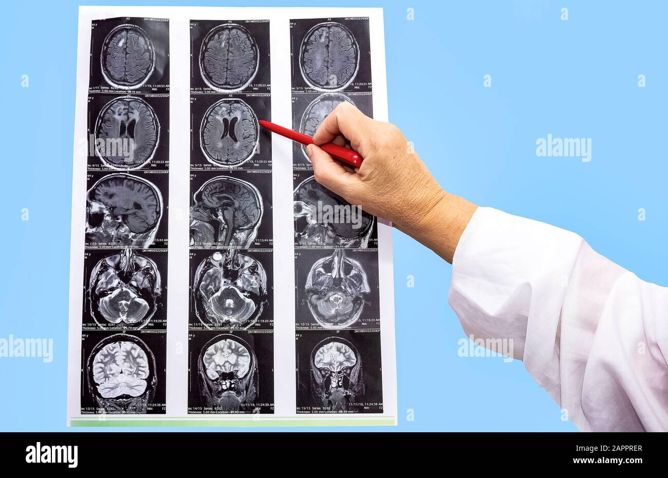 The magnetic resonance image or MRI of the male brain and hand of ...