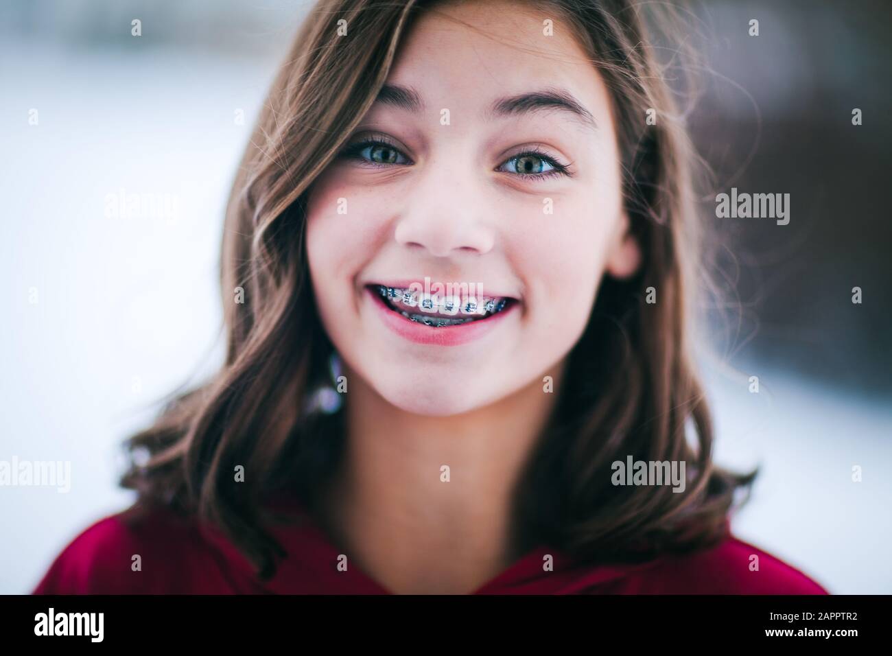 Young girl with dental braces hires stock photography and images Alamy