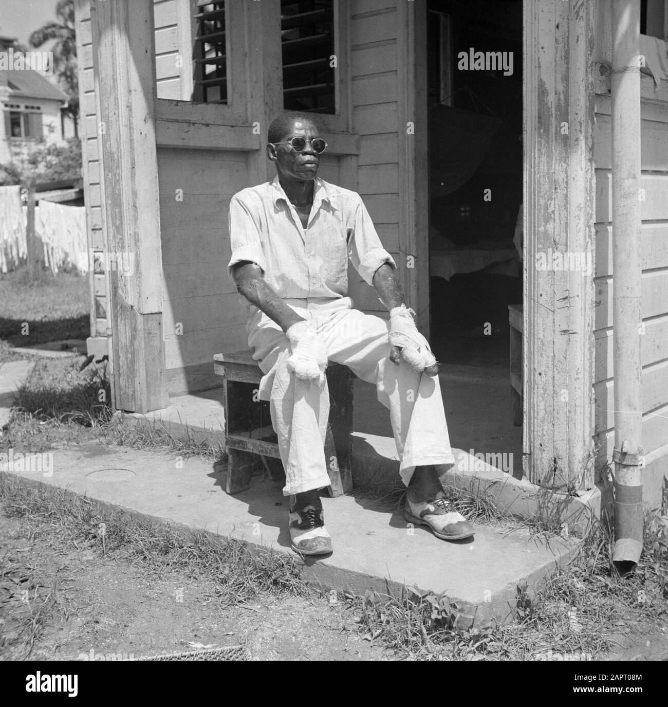 Travel to Suriname and the Netherlands Antilles A patient in leprozerie  Bethesda of the Protestant Association to Nursing of Lepralijders in  Suriname Date: 1947 Location: Suriname Keywords: leprosy, hospitals Stock  Photo - Alamy