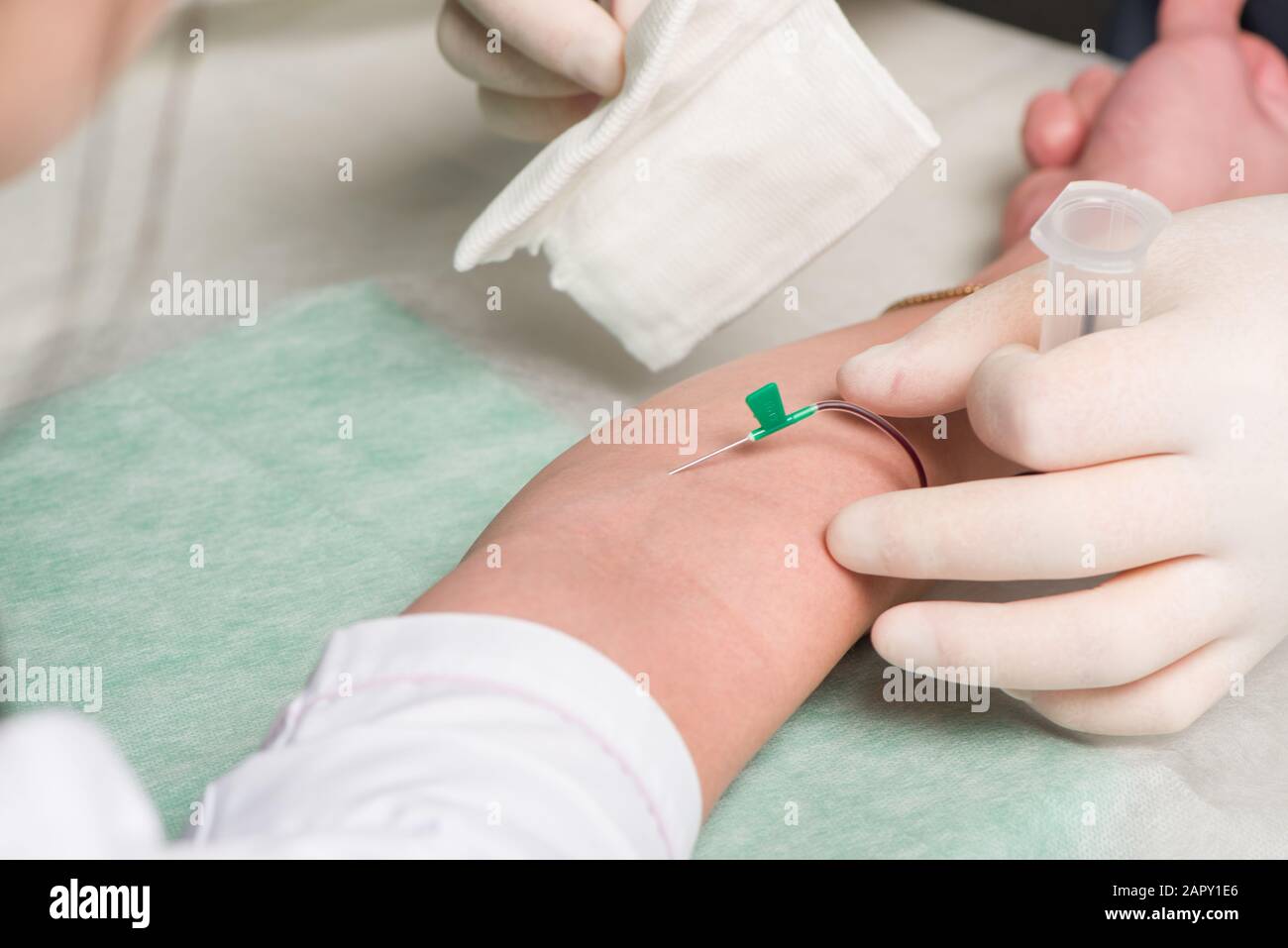 Hand in latex medical gloves perform vein puncture in area of ulnar bend of patient 's hand Stock Photo
