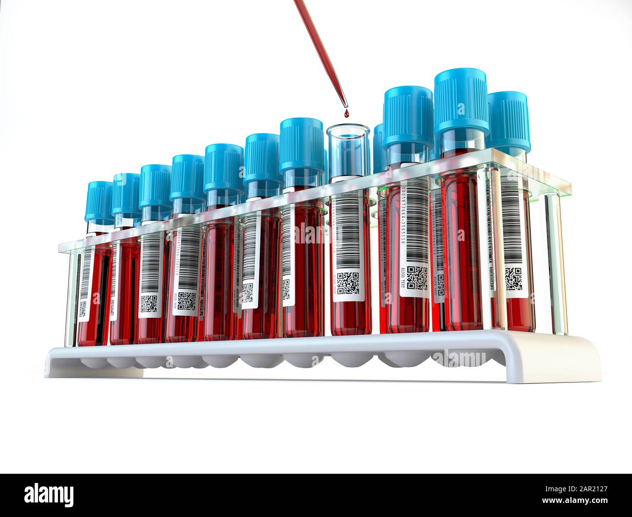 Центрифужные пробирки 100 мл. Подписывать пробирки. Подписывать пробирки. Венозная кровь в пробирке. Забор материала кровь.