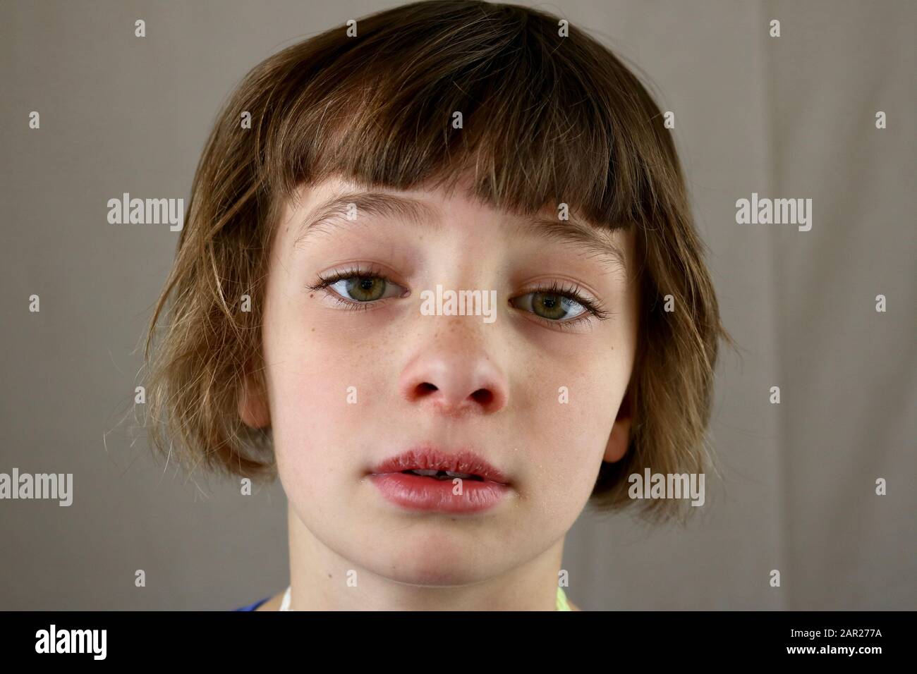 Portrait of a sick child with a sore nose and chapped lips Stock Photo