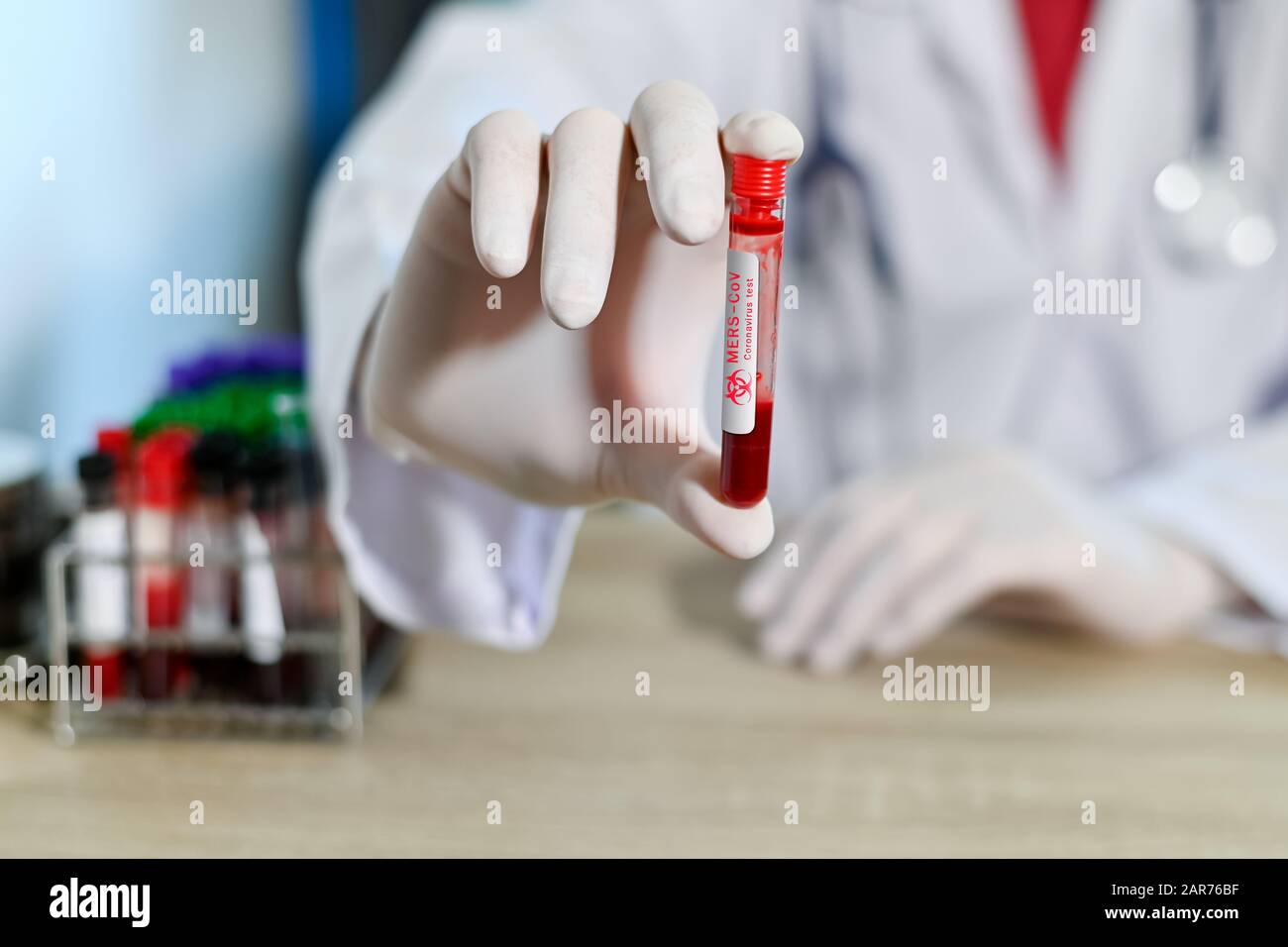 Blood test tube in doctor hand, Mers-CoV Coronavirus test label in hospital blood test tube for analysis. 2019-nCoV virus infection originating in Stock Photo