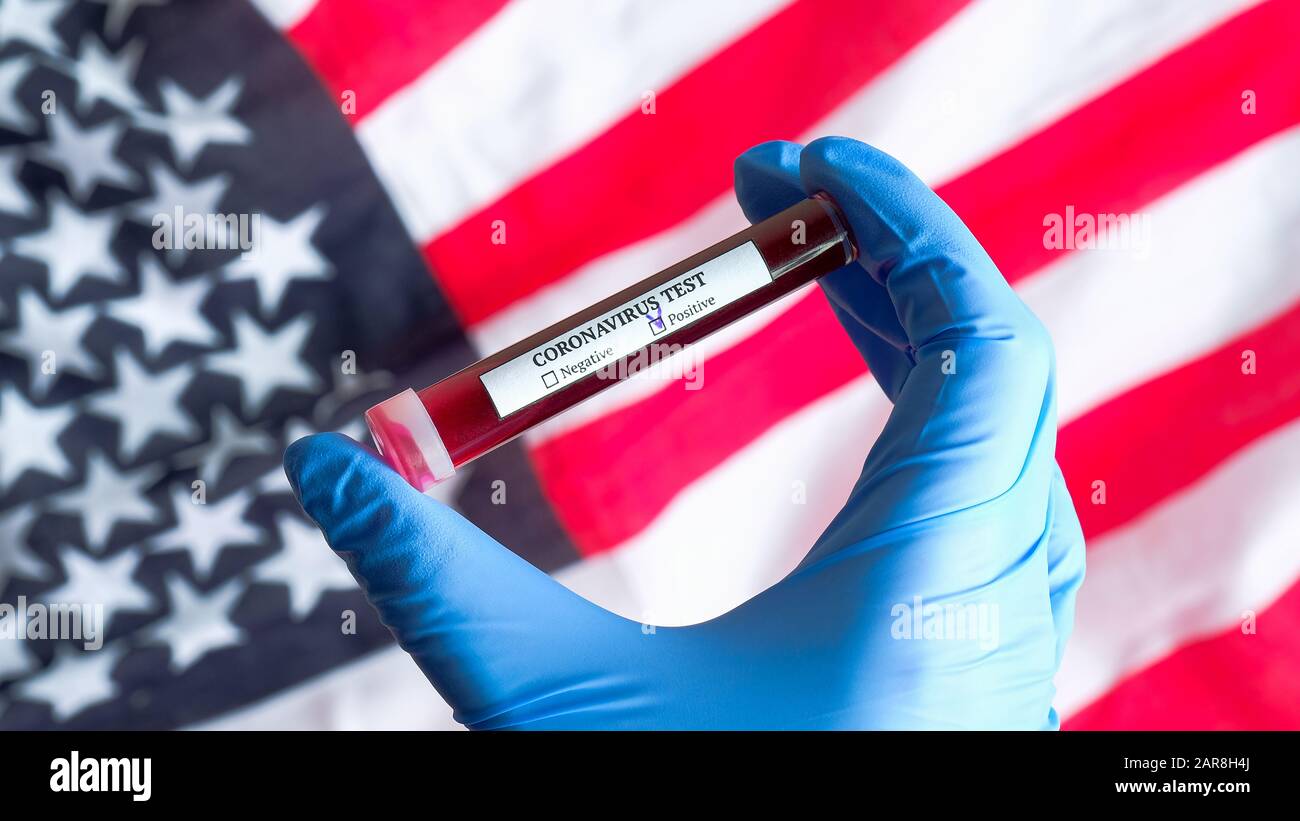 Coronavirus outbreak in USA concept. Nurse hand in gloves holding test tube with blood over flag of the United States of America. Blood test for Novel Stock Photo
