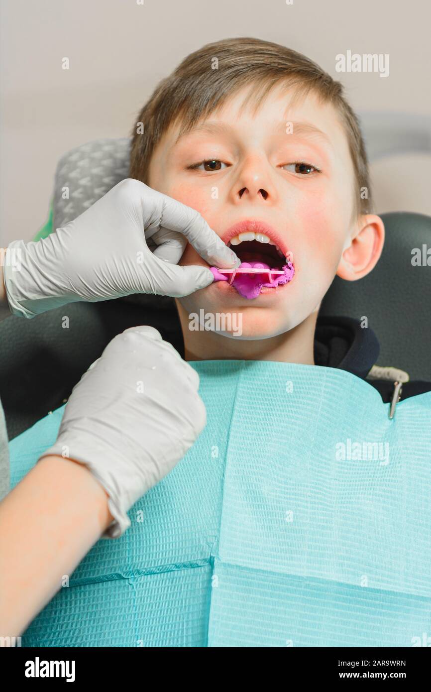 Boy in dentist chair with dental impression tray in her mouth Stock