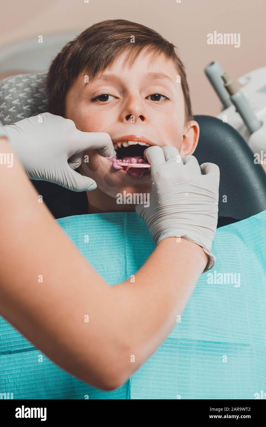 Boy in dentist chair with dental impression tray in her mouth Stock