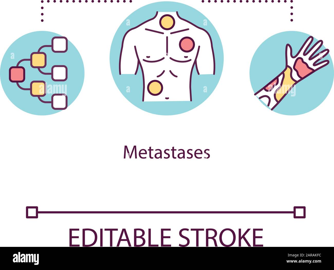 Malignant neoplasm Stock Vector Images Alamy