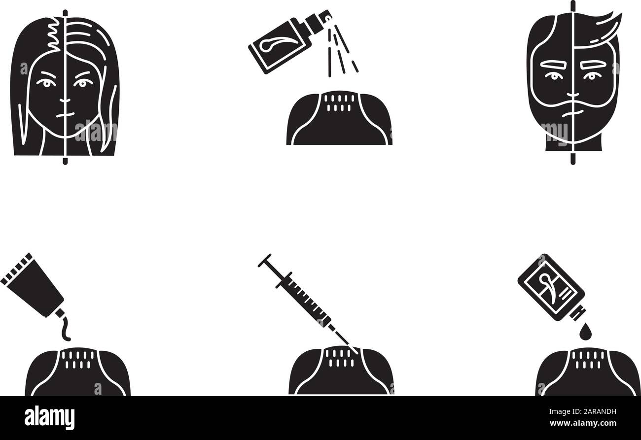 Hair Loss Black Glyph Icons Set On White Space Male Alopecia