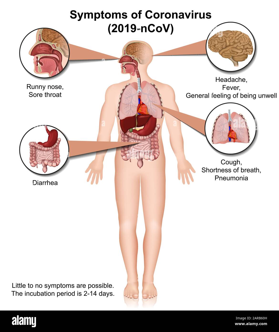 Coronavirus medical vector infographic, symptoms Stock Vector