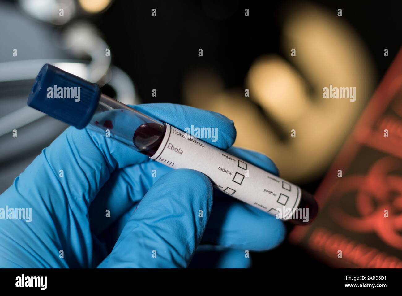 Blood sample test for disease and virus spread to humans. Global pandemic and flu outbreak. Laboratory research for coronavirus, Ebola, SARS, MERS and Stock Photo