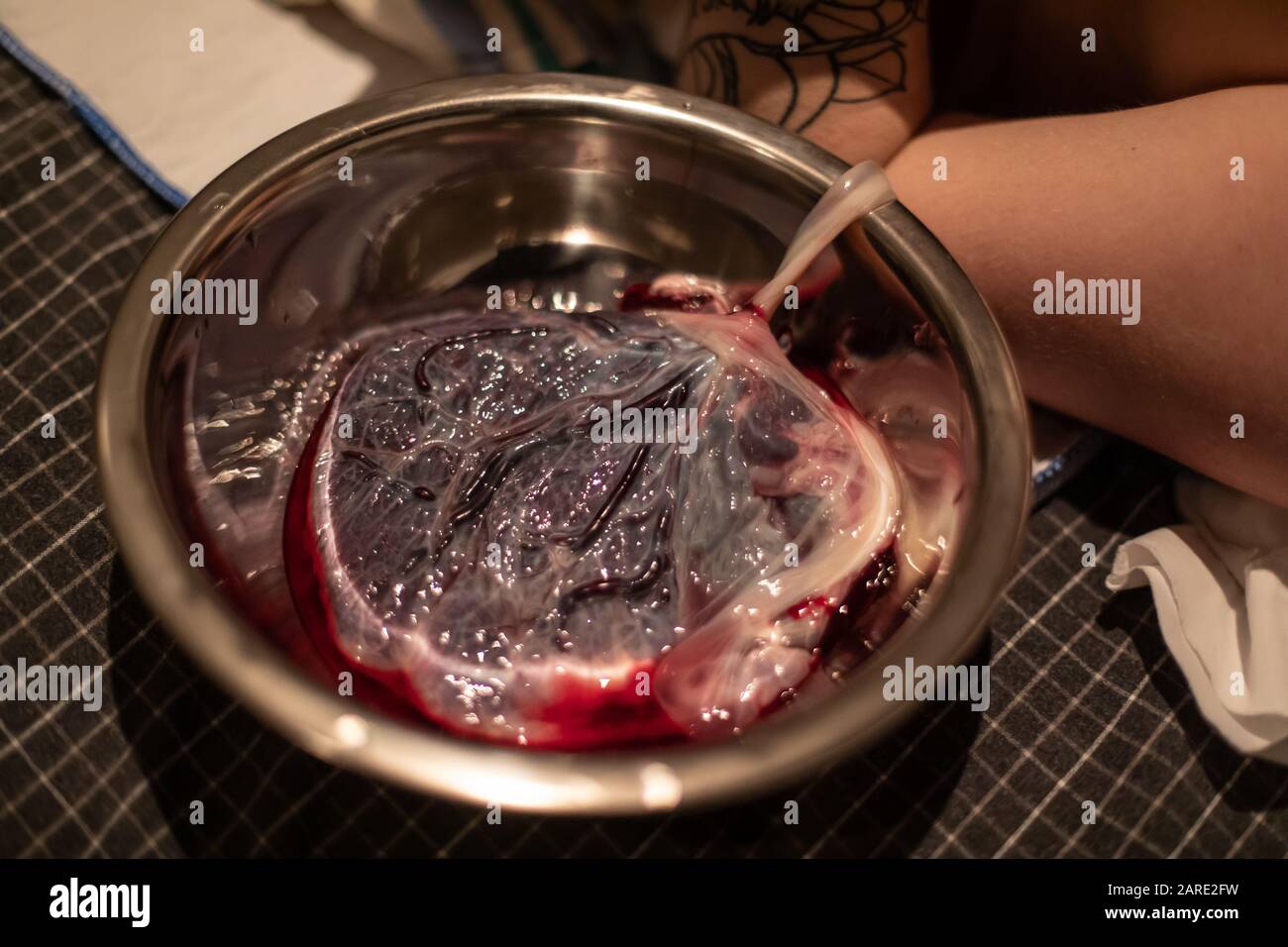 A close up detailed view of a bloody human placenta, maternal side, with intact umbilical cord in a sterile dish shortly after childbirth, copy space to sides Stock Photo