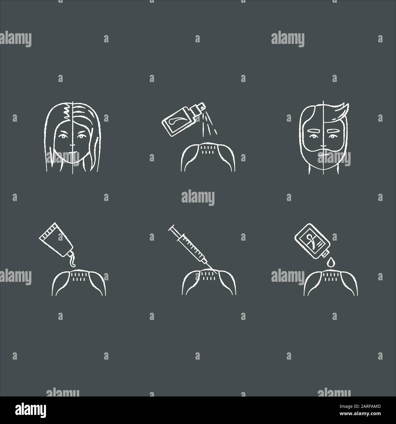 Hair Loss Chalk White Icons Set On Black Background Male Alopecia