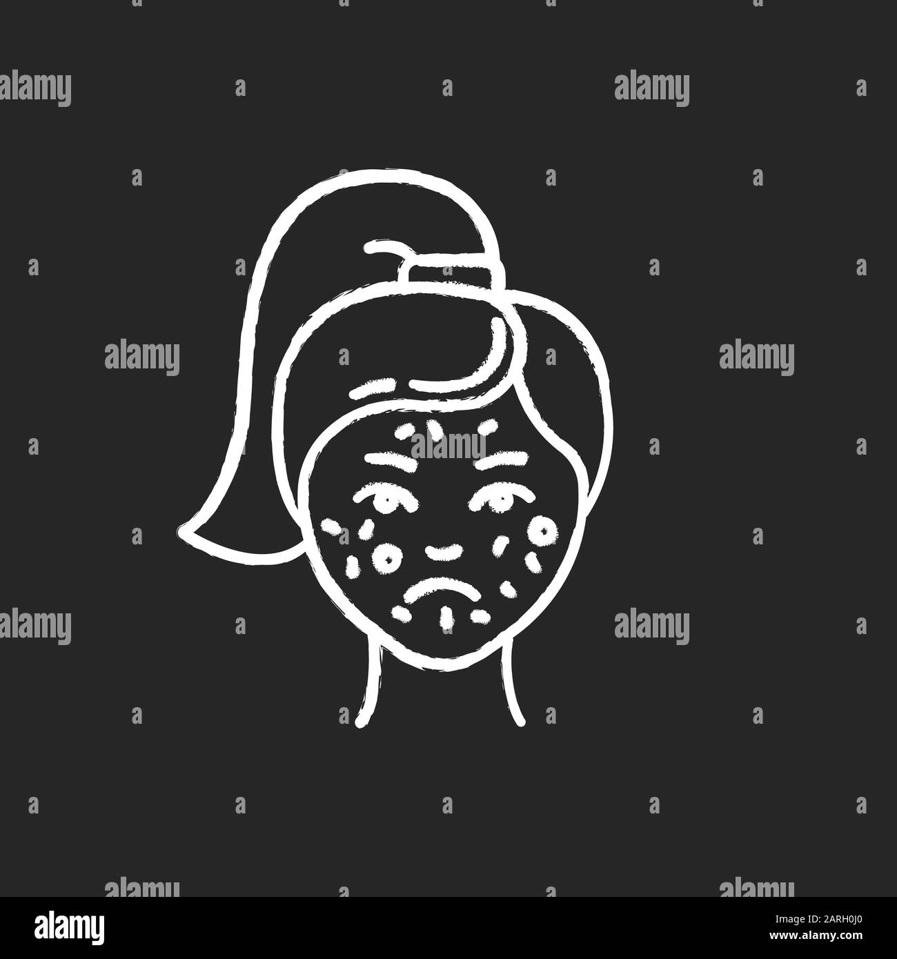 Acne chalk icon. Pimples on female face. Skincare for inflammation and irritation. Facial treatment. Puberty and teenager health problem. Dermatology. Stock Vector