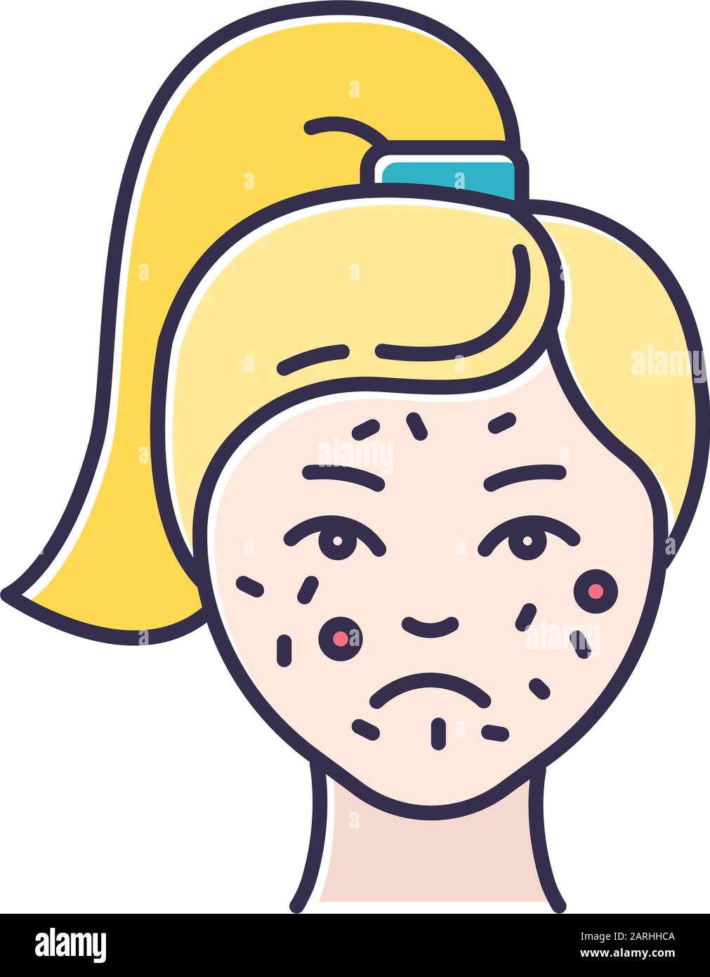 Acne color icon. Pimples on female face. Skincare for inflammation and irritation. Facial treatment. Puberty and teenager health problem. Cosmetology Stock Vector