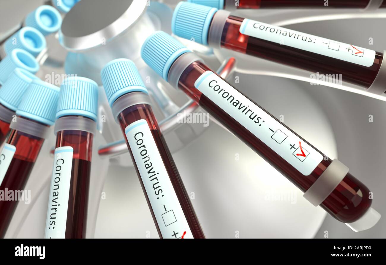 Coronavirus, group of viruses that cause diseases in mammals and birds. In humans, the virus causes respiratory infections. 3D illustration. Stock Photo