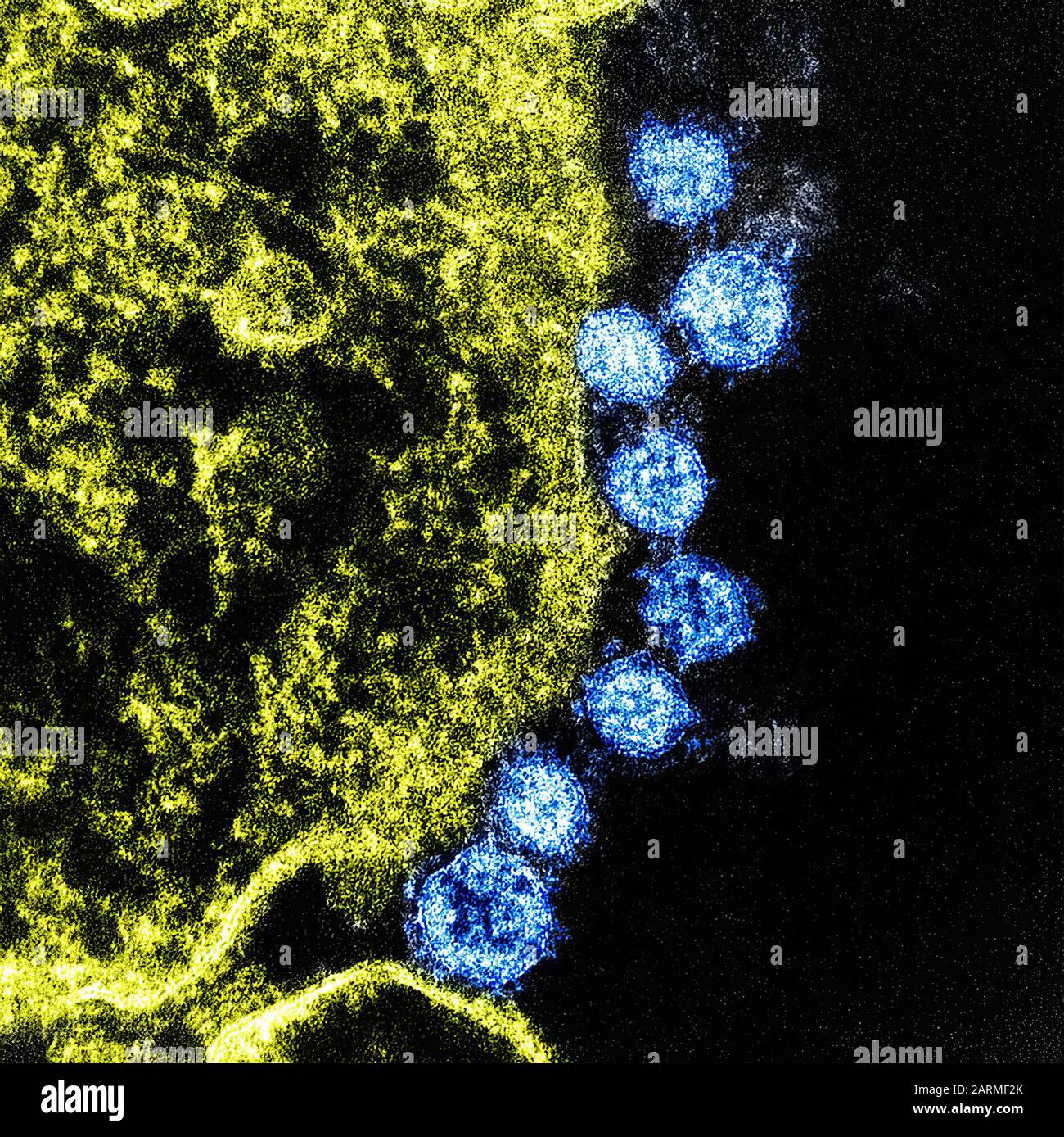 Colorized transmission electron micrograph MERS virus particles (blue) found near the periphery of an infected VERO E6 cell (yellow). Image captured and color-enhanced at the NIAID Integrated Research Facility in Fort Detrick, Maryland.2019 Novel Coronavirus (2019-nCoV) is a virus (more specifically, a coronavirus) identified as the cause of an outbreak of respiratory illness first detected in Wuhan, China. Stock Photo