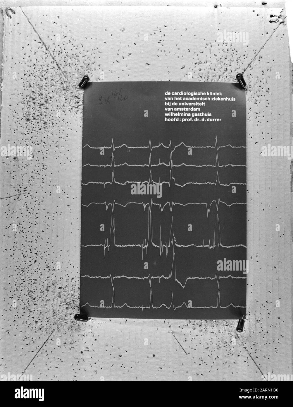 Heart cardiogram Date: 29 February 1972 Location: Amsterdam, Noord-Holland Keywords: Cardiology, Medicine Institution name: Wilhelmina Gasthuis Stock Photo