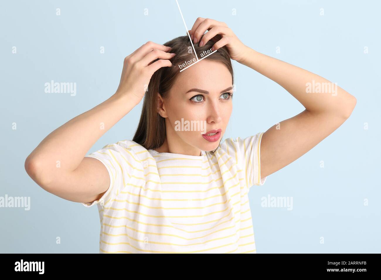 Woman before and after hair loss treatment on color background Stock