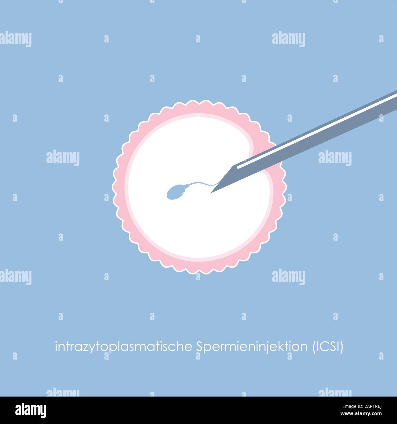 fertility reproduction of ovum and spermatozoon ICSI vector illustration EPS10 Stock Vector