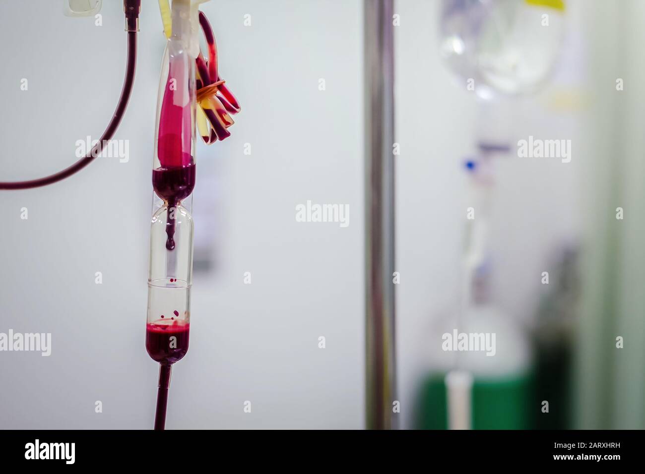 Closeup Blood transfusion intravenous to a patient in the hospital hand held shooting Stock Photo