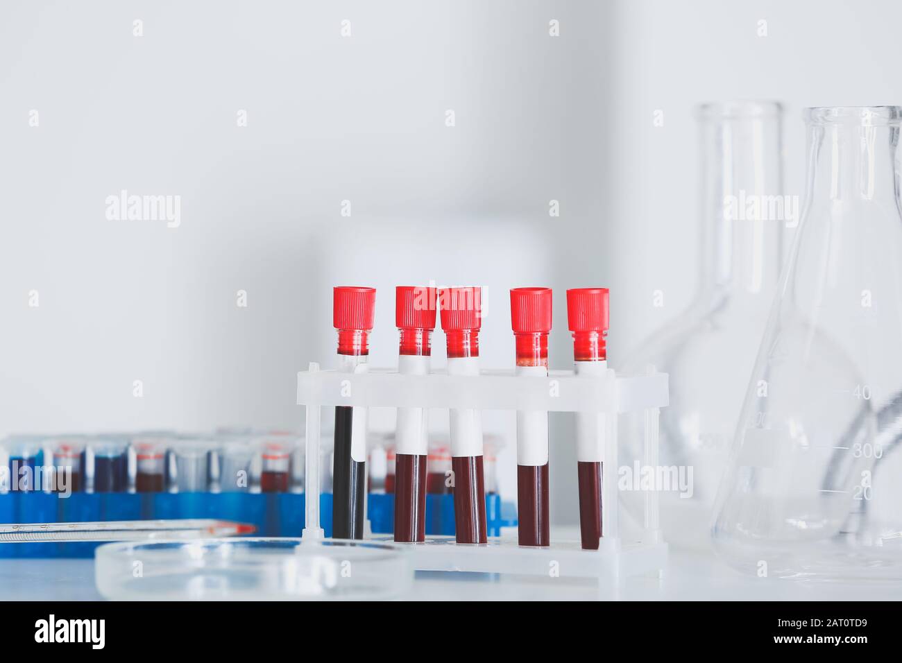 Test tubes with blood samples on table in laboratory Stock Photo - Alamy