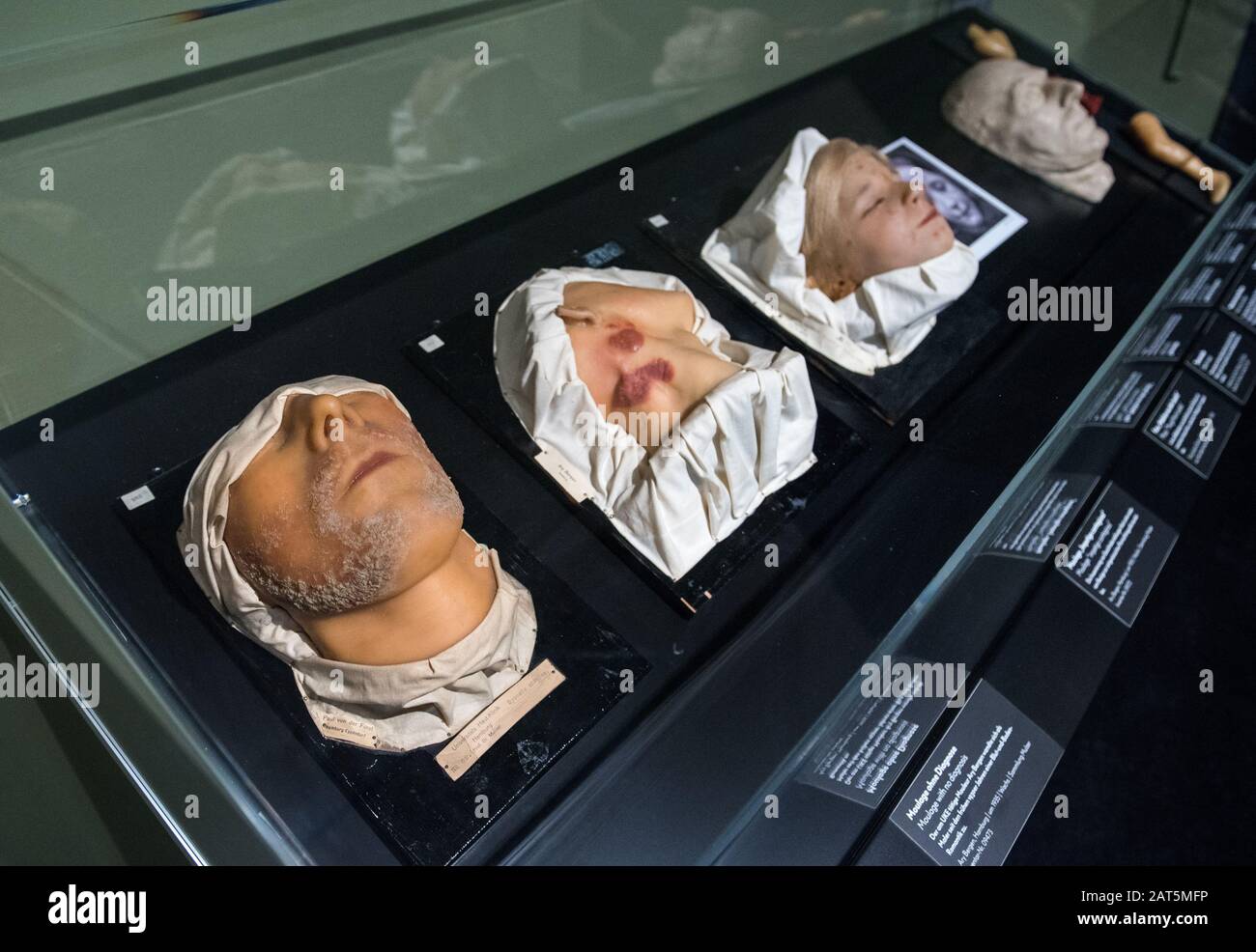 Hamburg Germany 30th Jan Historical Moulages Are Exhibited In The Medizinhistorisches Museum Hamburg On The