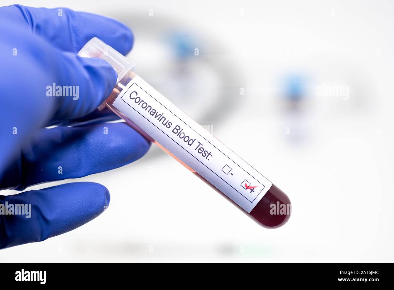 Coronavirus positive blood in a blood collection tube Stock Photo