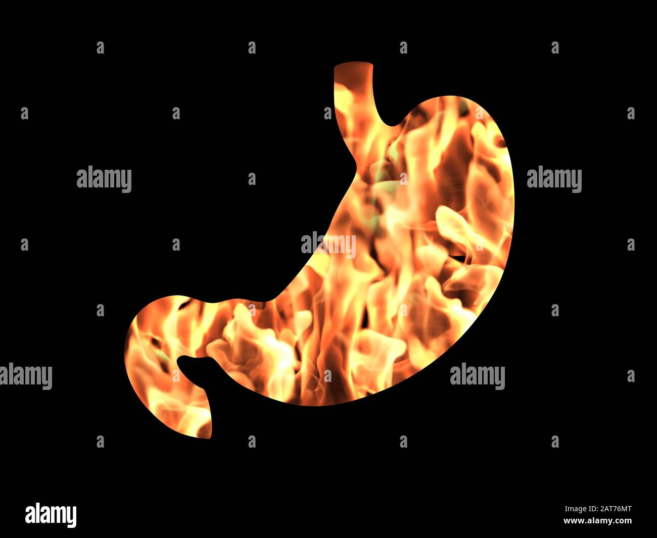 An abstract illustration of human stomach with heartburn disease Stock Photo