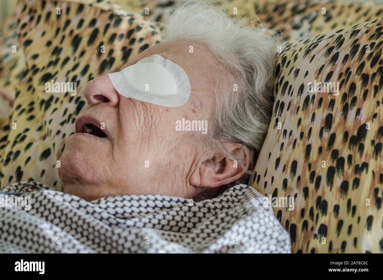 closeup of an old person with eye bandage after cataract operation Stock Photo