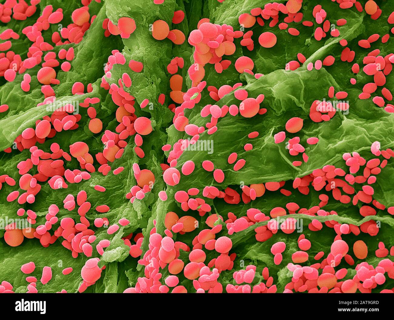 Insect scanning electron microscope hi-res stock photography and images ...