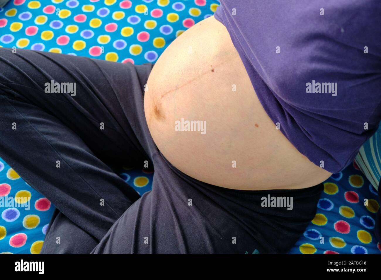 The belly of a Caucasian pregnant girl on the bed. It is visible the Linea nigra (Latin for 'black line'), often referred to as a pregnancy line. Stock Photo