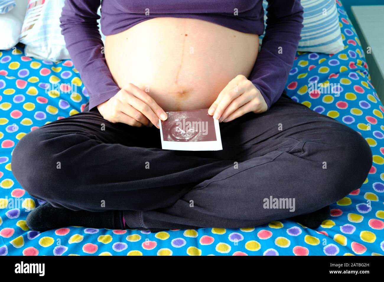 x ray of pregnant woman's abdomen